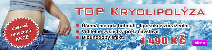 TOP Kryolipolýza