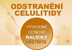 Odstranění celulitidy, ceník