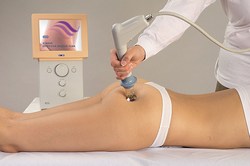 Unique achievements in the fight against cellulite at Beauty Clinic